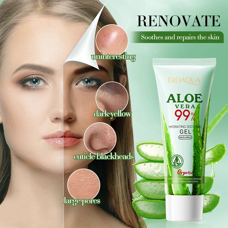 Gel Aloe Vera Lenitivo Viso & Corpo – Idratazione Fresca & Comfort Pelle Sensibile | Lido Nova