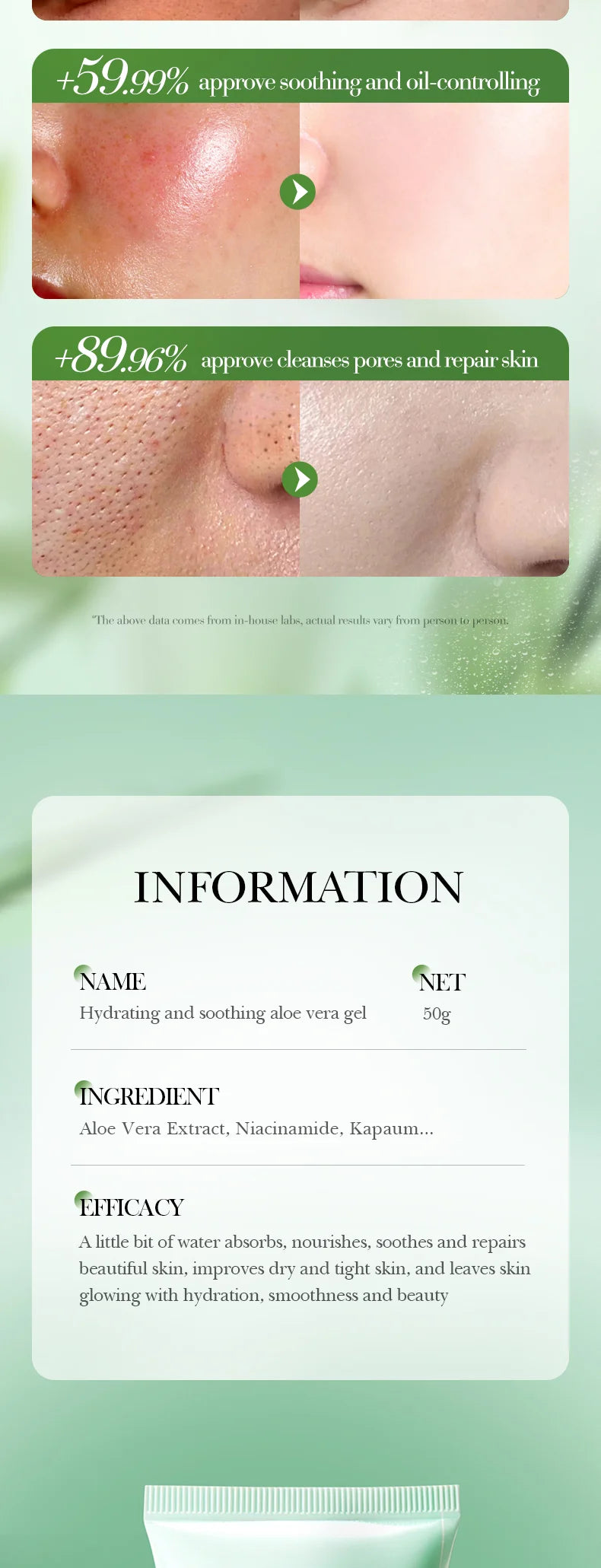 Gel Aloe Vera Lenitivo Viso & Corpo – Idratazione Fresca & Comfort Pelle Sensibile | Lido Nova