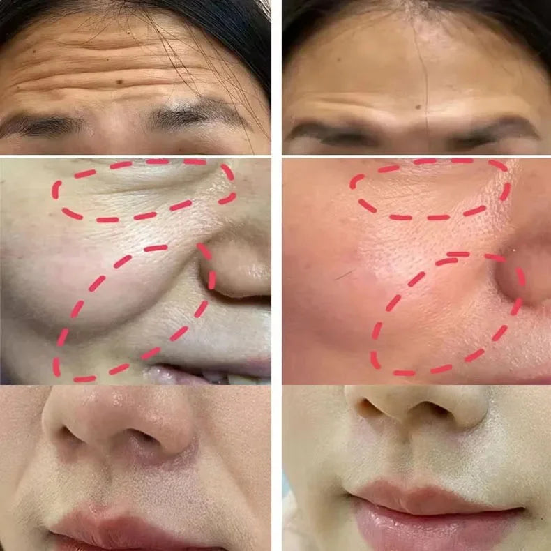 Balm Stick Bounce Idratante 7,5g – Comfort & Pelle dall'Aspetto più Disteso | Lido Nova