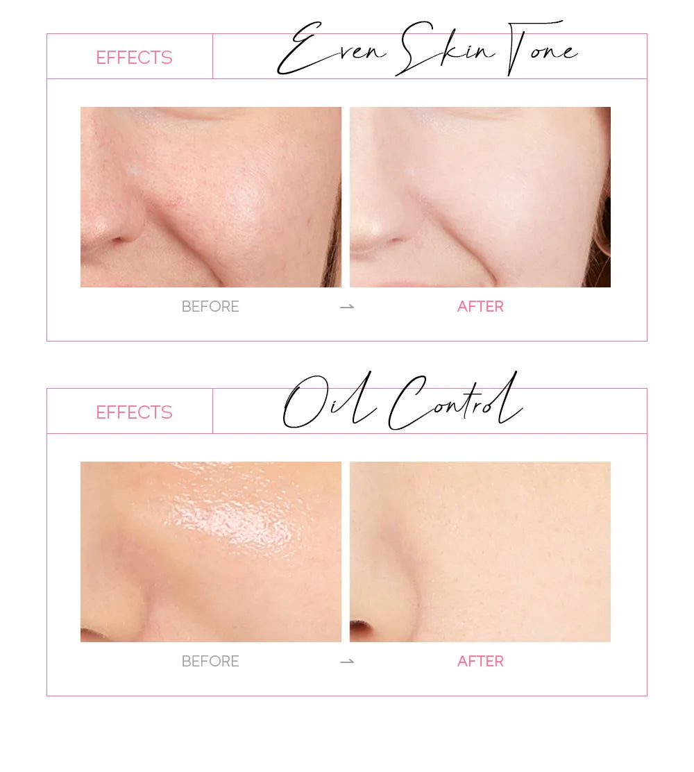 Maschera Peel-Off LAIKOU Sakura 24K Gold 1pz – Glow & Pori Clean Estate 2026 – Lido Nova