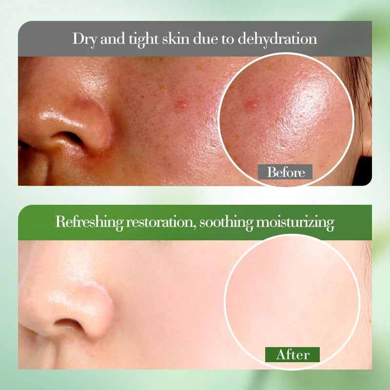 Gel Aloe Vera Lenitivo Viso & Corpo – Idratazione Fresca & Comfort Pelle Sensibile | Lido Nova